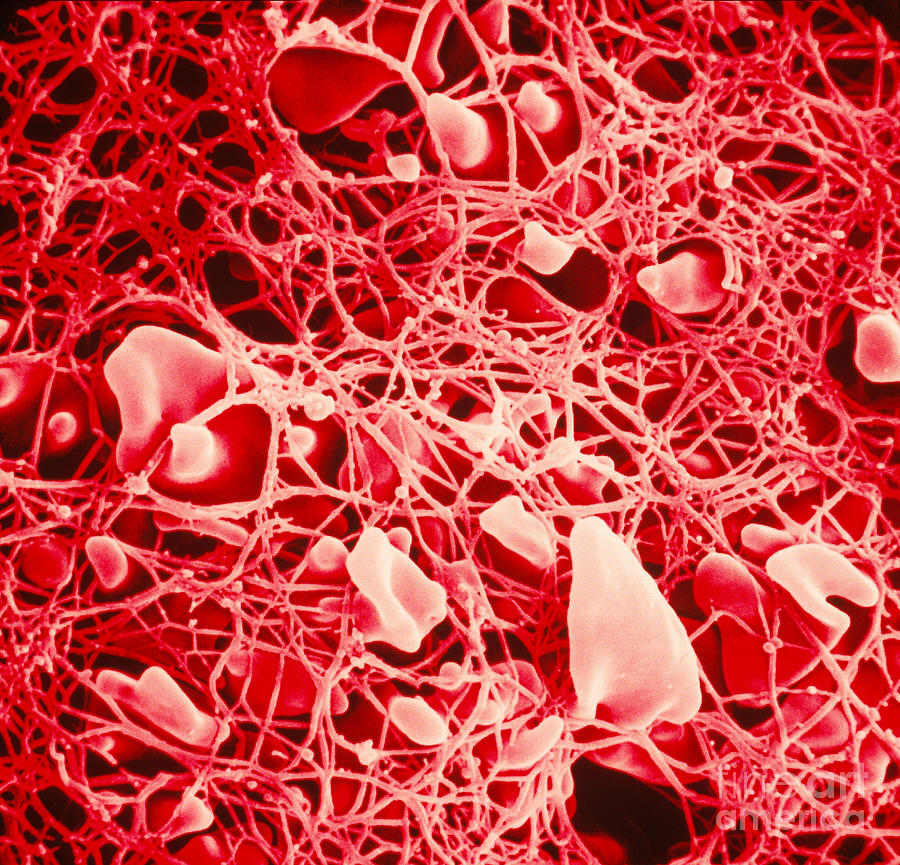 Human Blood Clot Photograph by David M. Phillips | Fine Art America