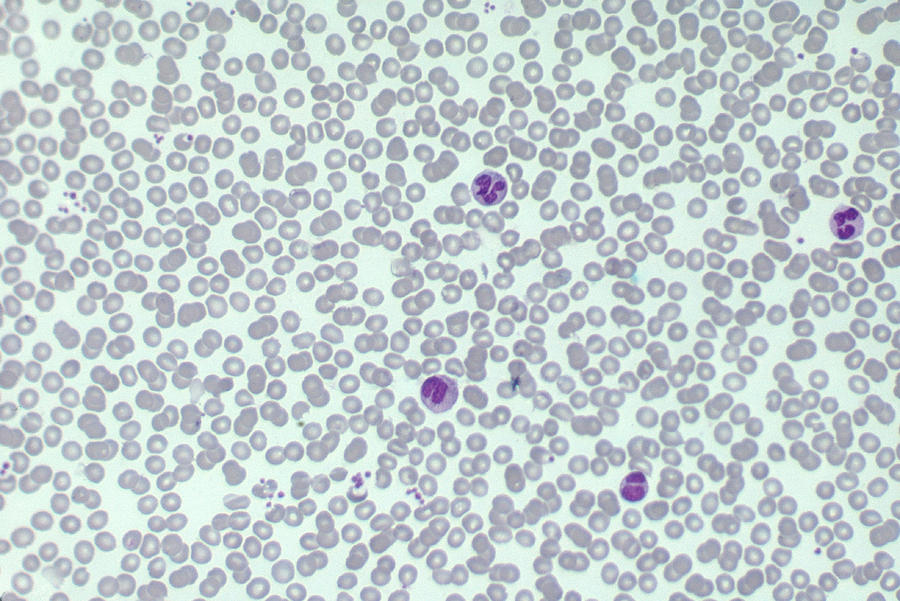 Human Blood Sample Photograph by Biology Pics
