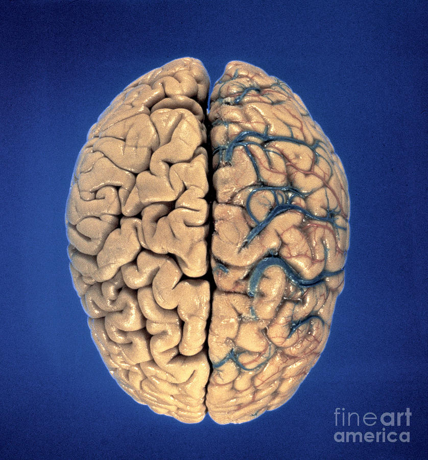 Human Brain Photograph by David Bassett
