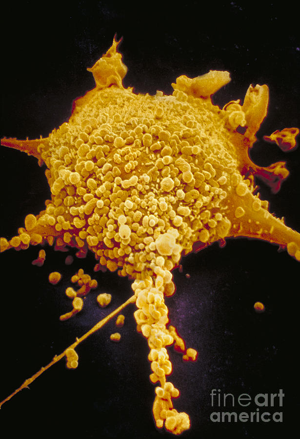Mycoplasma Photograph - Human Cell Infected With Mycoplasma by David M. Phillips