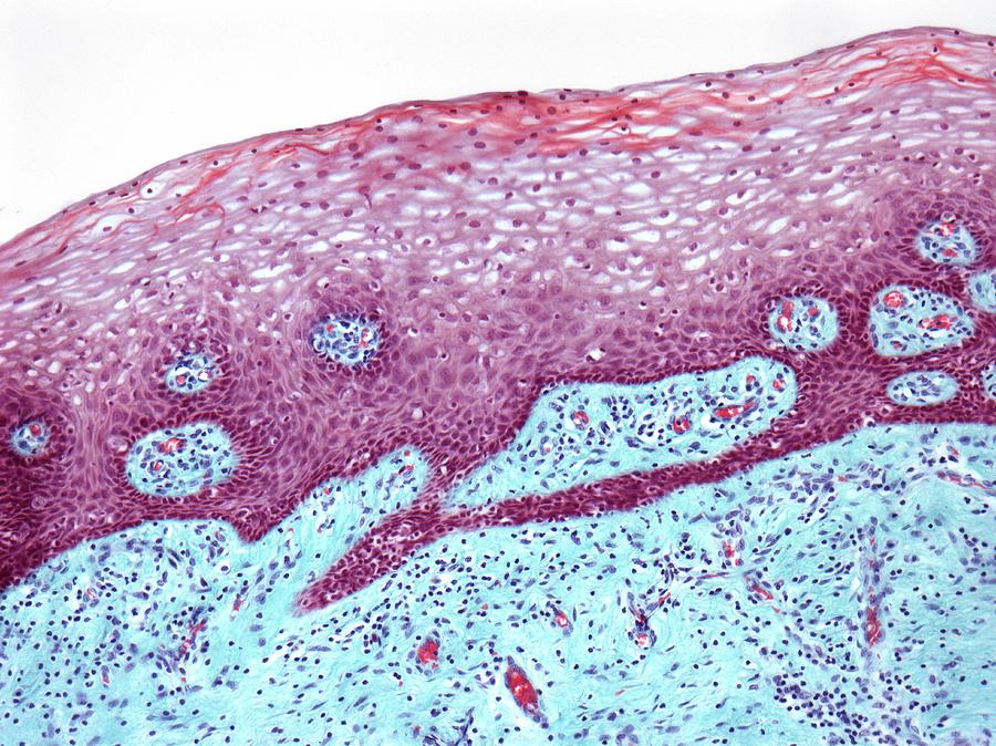 Structure Of The Cervix