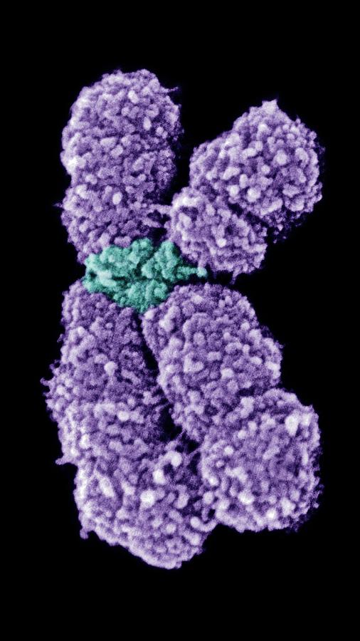 Human Chromosome 10 Photograph by 