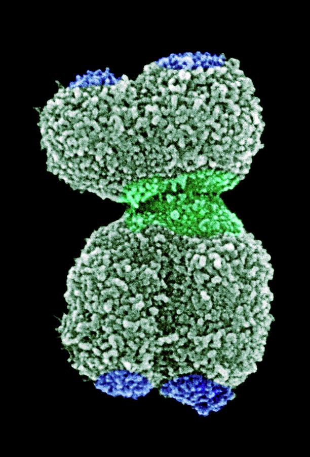 Human Chromosome 16 Photograph by 