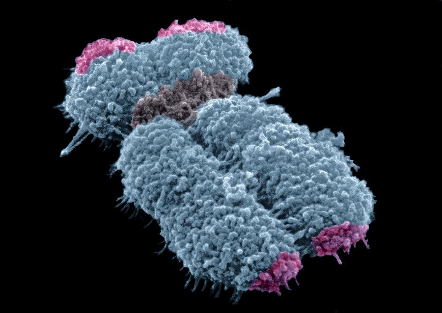 Human chromosome, SEM Photograph by Science Photo Library