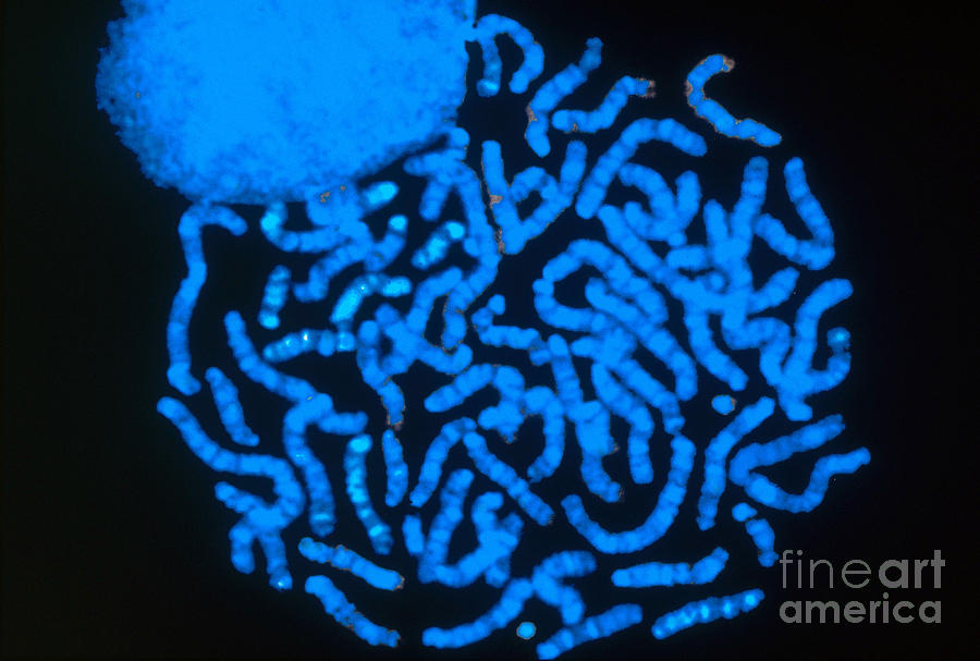 Human Chromosomes, Lm Photograph by David M. Phillips