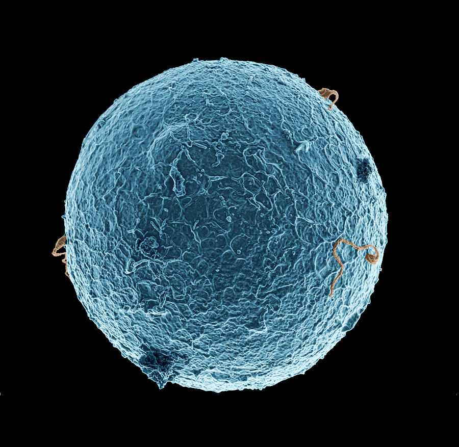 Human Egg Cell And Sperm Cells Photograph by Thierry Berrod, Mona Lisa Production/ Science Photo Library