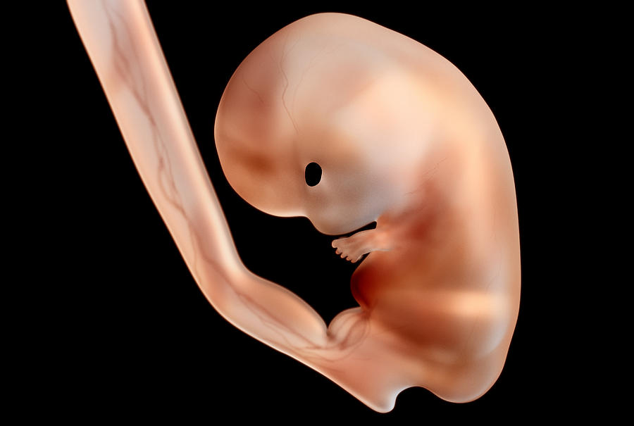 Human Embryo Photograph by Luismmolina