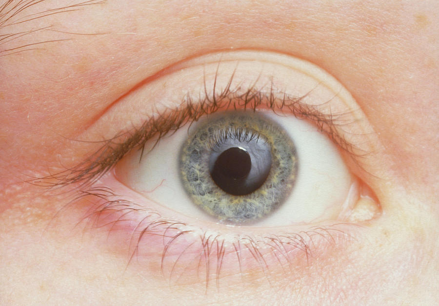 eye pupil dialation