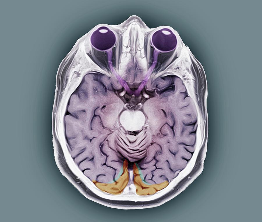 human brain with eyes
