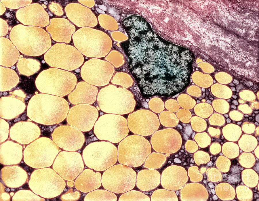 Human Fat Cell Photograph by David M. Phillips