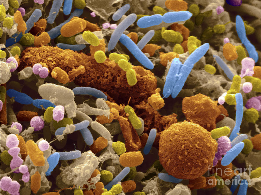 Human Feces Containing Bacteria Photograph by Scimat