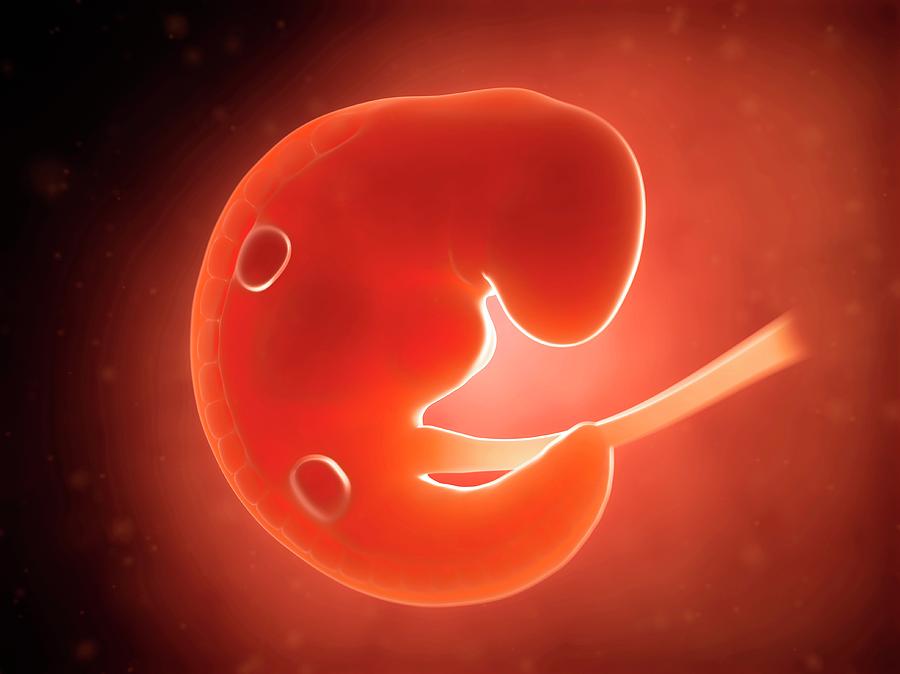 Human Fetus At 1 Month Photograph by Sebastian Kaulitzki