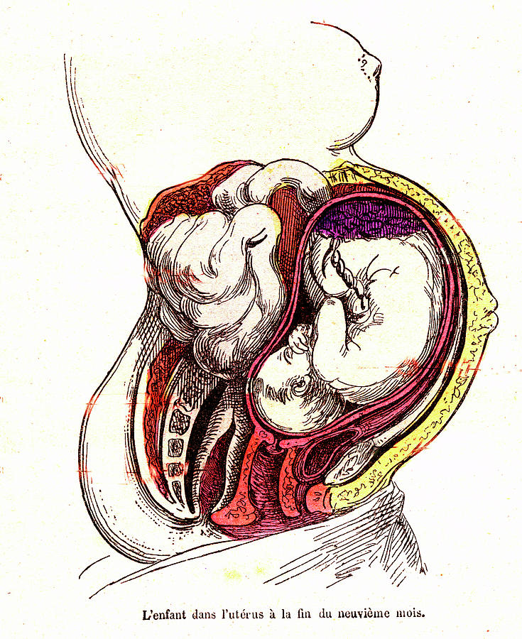 Human Foetus In Womb Photograph by Collection Abecasis/science Photo Library