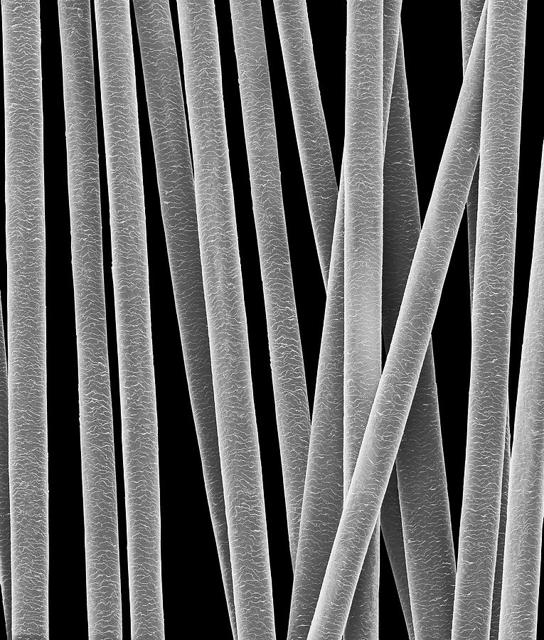 Human Hair Shafts Photograph by Dennis Kunkel Microscopy/science Photo Library