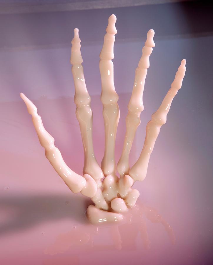 Human Hand Skeleton Photograph By Pascal Goetgheluck science Photo 