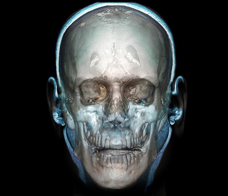 Skull Photograph - Human Head by Zephyr/science Photo Library