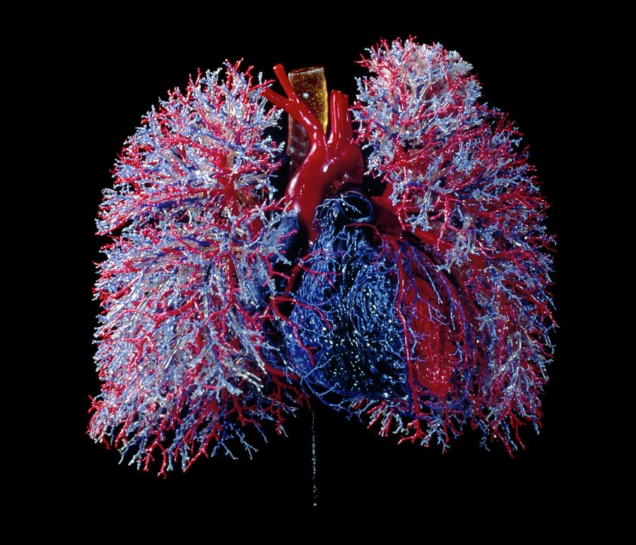 Human Heart And Lung Blood Vessels Photograph by Clouds Hill Imaging Ltd