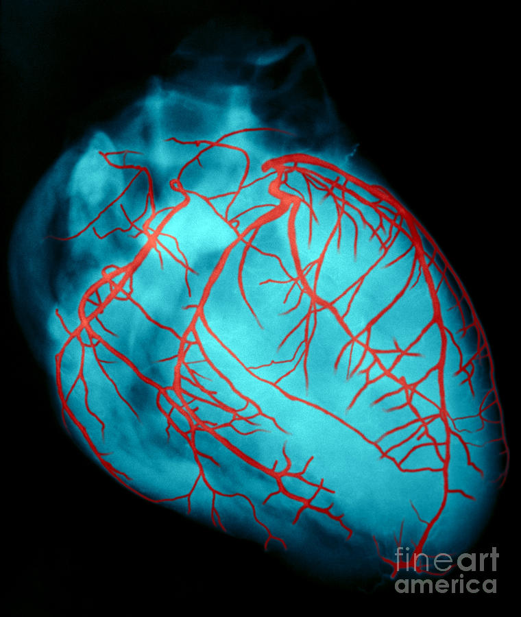 Human Heart Photograph by David Bassett