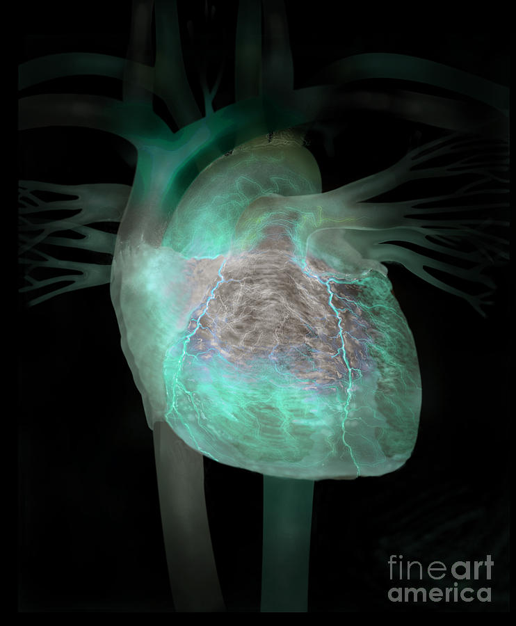 Human Heart Illustration Photograph by Jim Dowdalls