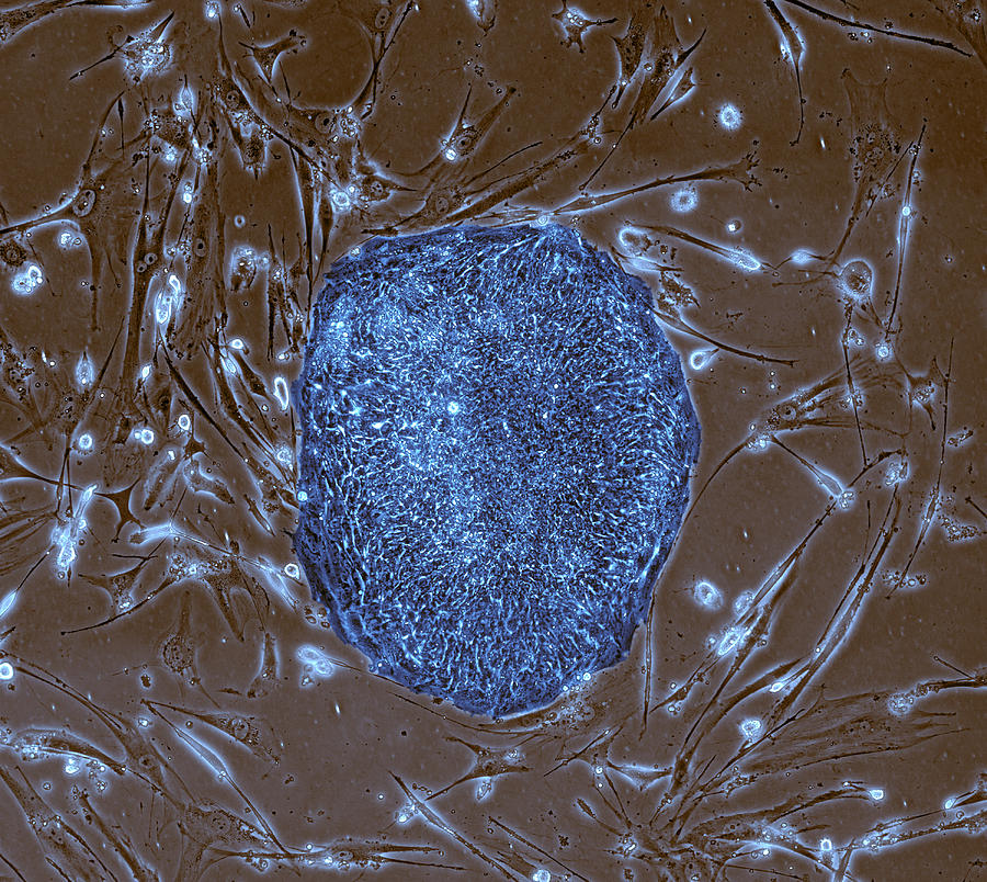 Human Induced Pluripotent Stem Cells, Lm Photograph by Science Source