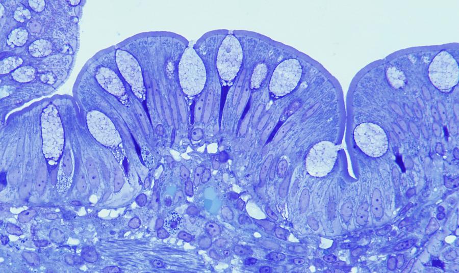 Gastrointestinal System Photograph - Human Intestine by Microscape
