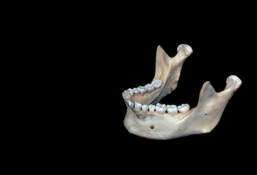 Human Jaw Photograph by Biology Pics