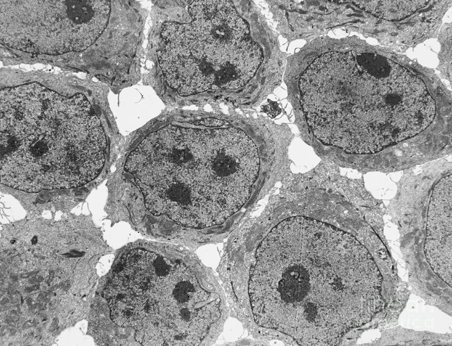 Human Kb Cells Tem Photograph by David M. Phillips