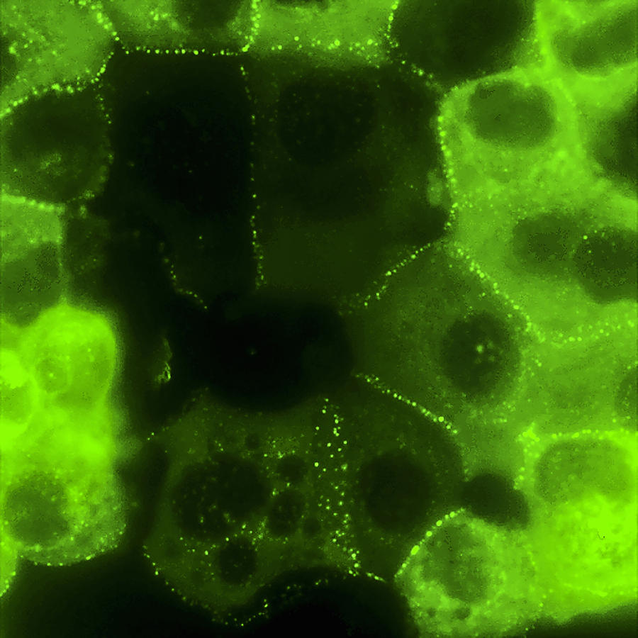 Human Keratinocytes, 2 Of 4 Photograph by Alvin Telser