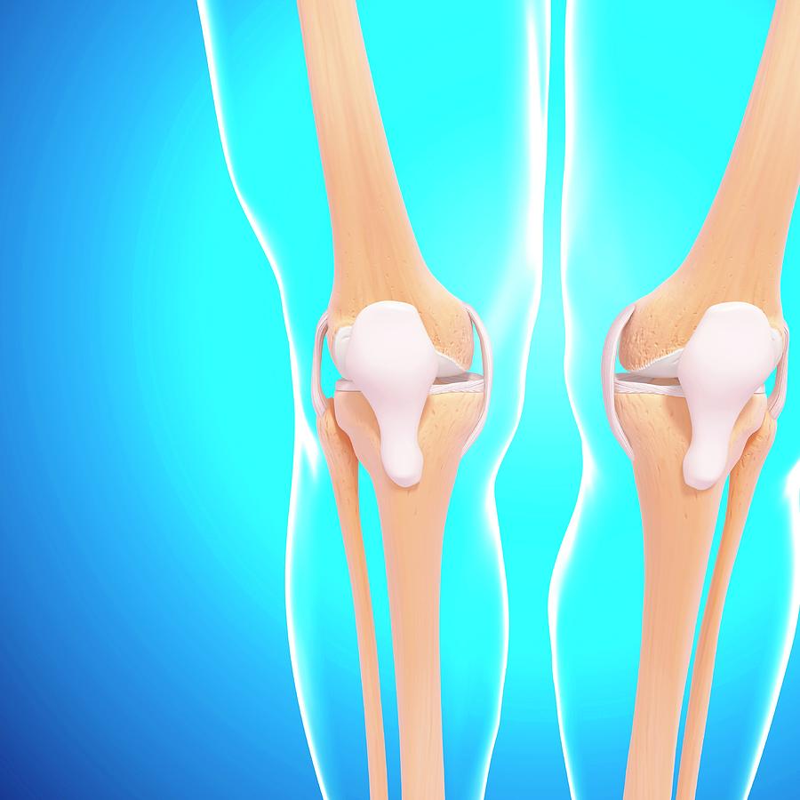 Human Knee Joints Photograph by Pixologicstudio Pixels