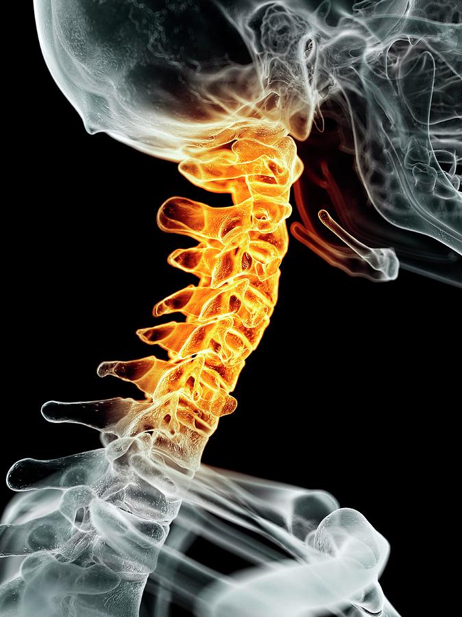 Human Neck Photograph By Sciepro Fine Art America