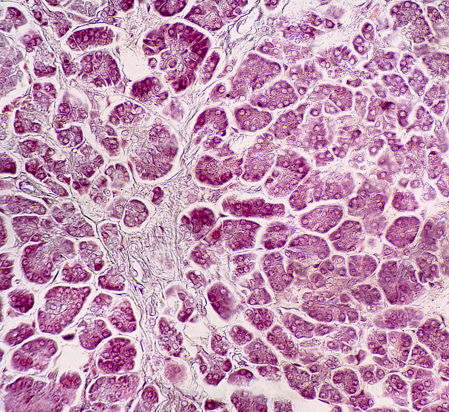 Human Pancreas Section, Lm Photograph by Science Stock Photography ...