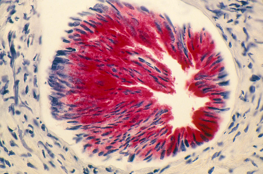 Human Prostate, Lm Photograph by Michael Abbey