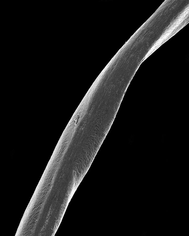 Human Pubic Hair Photograph by Dennis Kunkel Microscopy/science Photo  Library - Fine Art America