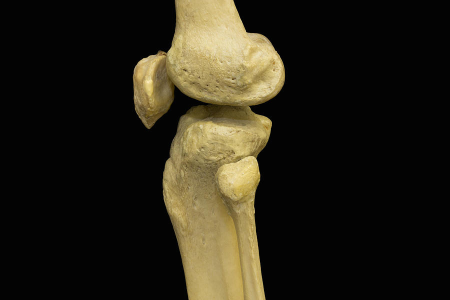 knee cap skeleton