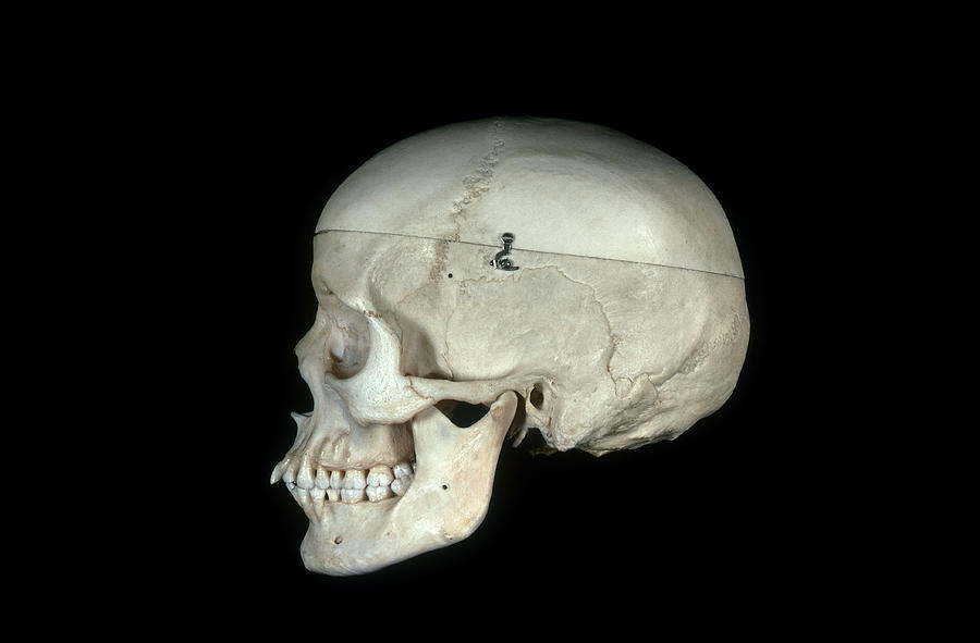 Human Skull Photograph by Biology Pics
