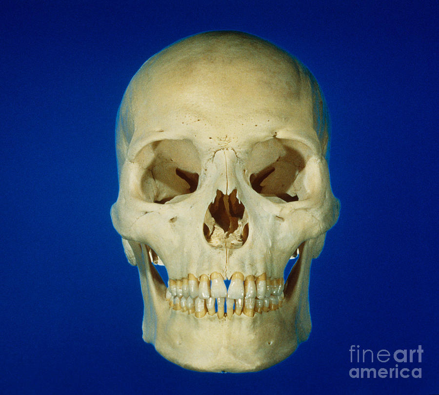Human Skull Photograph by VideoSurgery