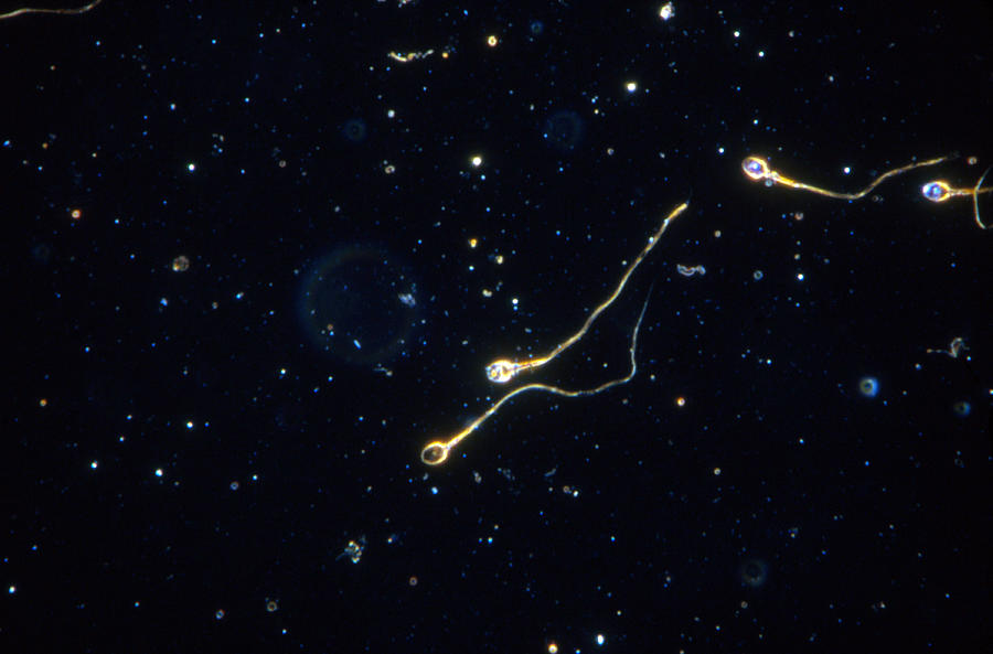 Human Sperm, Dark Field Microscope Photograph by Michael Abbey