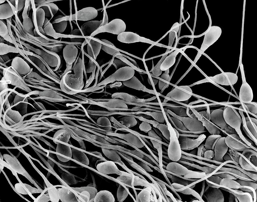 Human Sperm Photograph by Dennis Kunkel Microscopy/science Photo Library