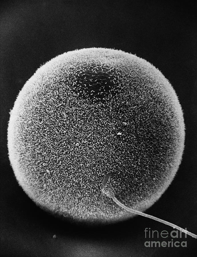 Human Sperm Fertilizing Hamster Egg Sem Photograph by David M. Phillips / The Population Council