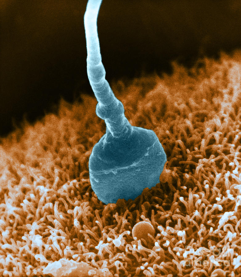 Human Sperm Fertilizing Hamster Egg Sem Photograph by David M. Phillips