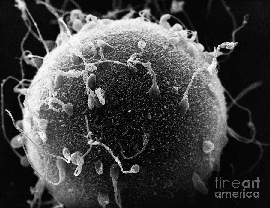 Human Sperm, Hamster Egg Sem Photograph by David M. Phillips / The Population Council
