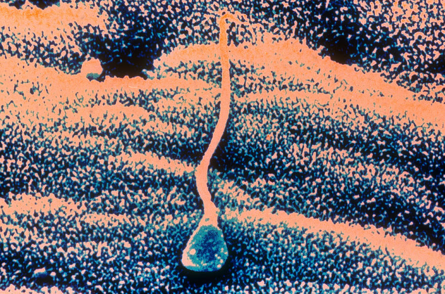 Human Sperm In Uterus Photograph by John Watney