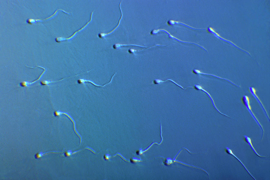 Human Sperm Photograph By Pascal Goetgheluckscience Photo Library Pixels 