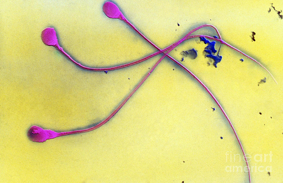Human Sperm, Sem Photograph by David M. Phillips