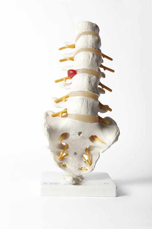 Human spine, anatomical model Photograph by Science Photo Library ...