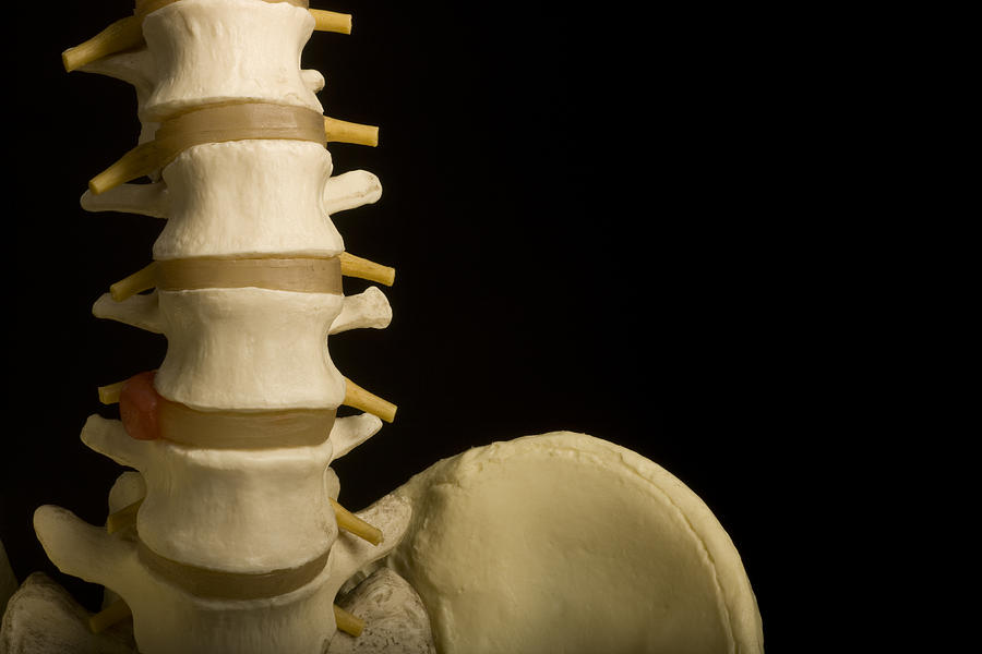 Human Spine, Pelvis, Chiropractic, Orthopedic, Medical Model, Heathcare, Isolated Photograph by 1Photodiva