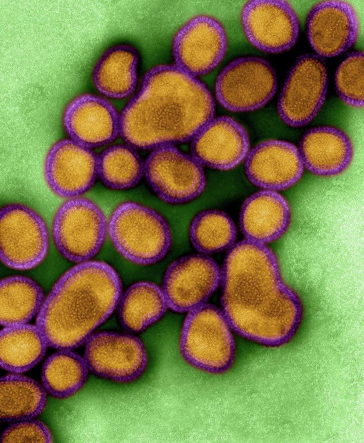 Human Swine Flu Virus H1n1 Photograph by Dennis Kunkel Microscopy/science Photo Library