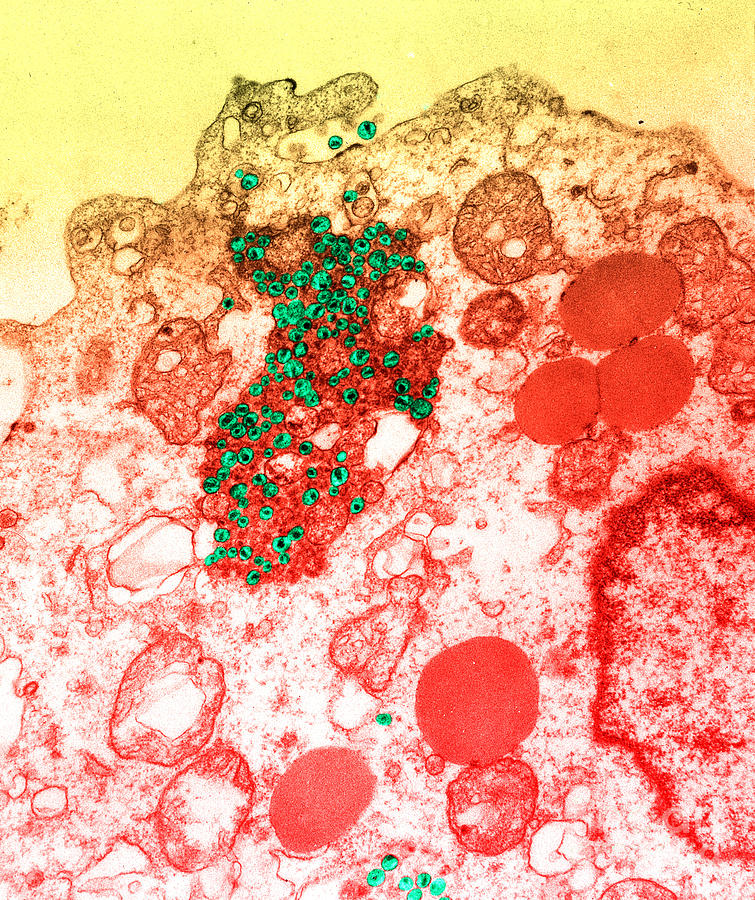Human T-lymphocyte Showing Hiv Photograph by Kwangshin Kim