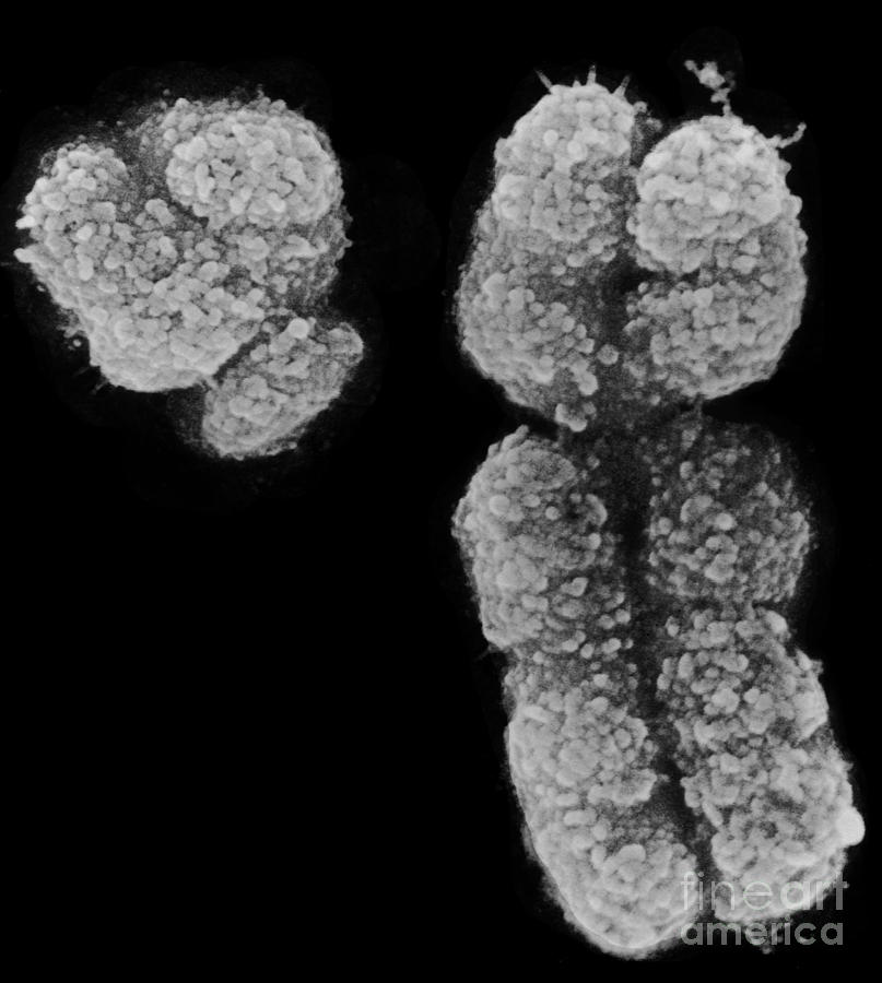 Human X And Y Chromosomes Photograph by Biophoto Associates