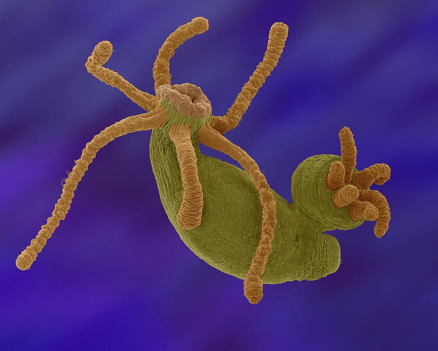 Hydra Sp. Budding (cnidarian) Photograph by Dennis Kunkel Microscopy/science Photo Library